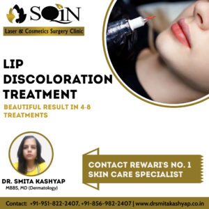 Lips Discolouration treatment in rewari